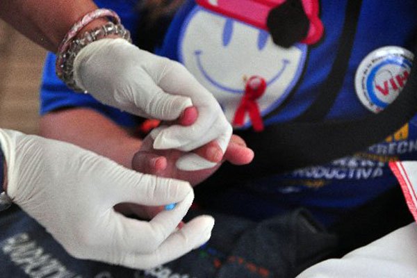 A scan through HIV/AIDS a Top Killer Disease in the Sub-Saharan Africa